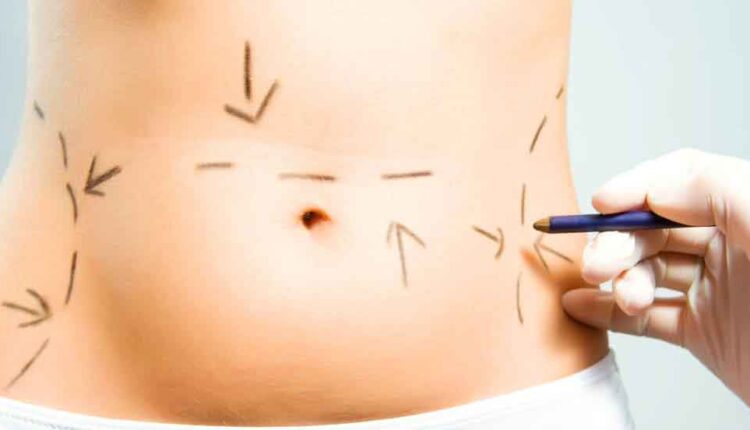 تجربتي مع دكتورة عبير الكبيسي