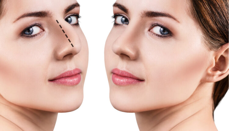 أسعار عمليات تجميل الأنف في السعودية 2023