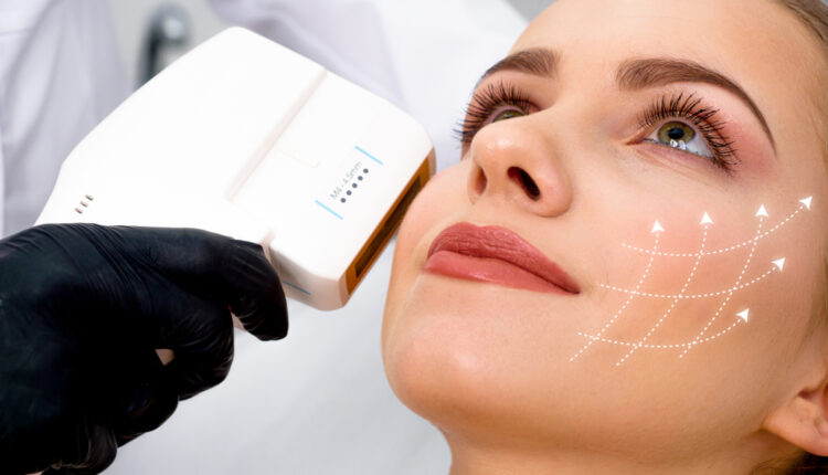 تكلفة عملية شد الوجه في الرياض