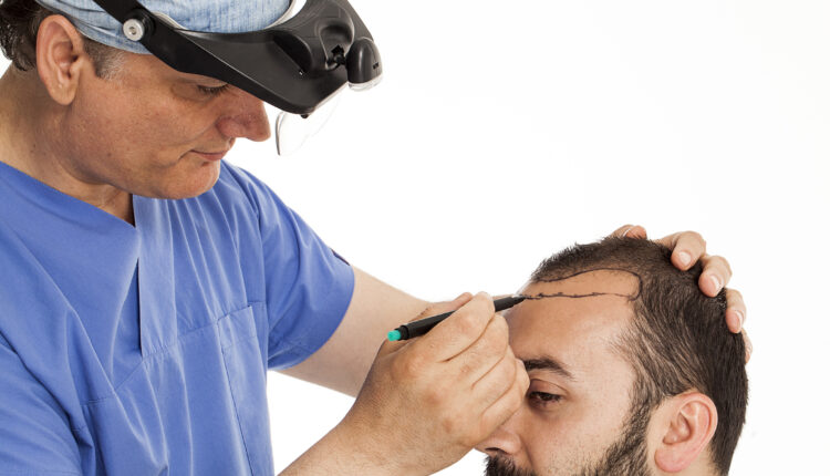زراعة الشعر في دبي - افضل عيادة لزراعة الشعر في دبي